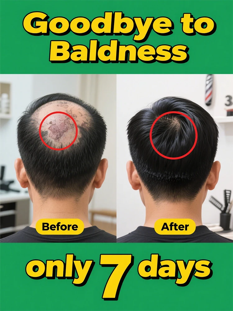 

Safe and healthy ʰᵃⁱʳ ᵍʳᵒʷᵗʰ essential oil: quickly nourishes ʰᵃⁱʳ ᶠᵒˡˡⁱᶜˡᵉˢ, revitalizes hair roots, and