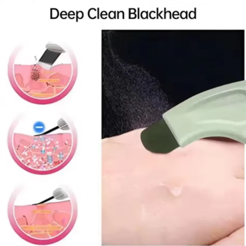 1/4pcs mix Stainless Steel Face New beauty shovel knife Nose Blackhead Deep Cleansing Skin Care Remover