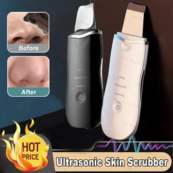 Ultrasonic Skin Scrubberskin Peeling Machine Blackhead Remove Deep Face Cleaning Ion Acne Pore Cleaner Spatula Shovel Scrubber