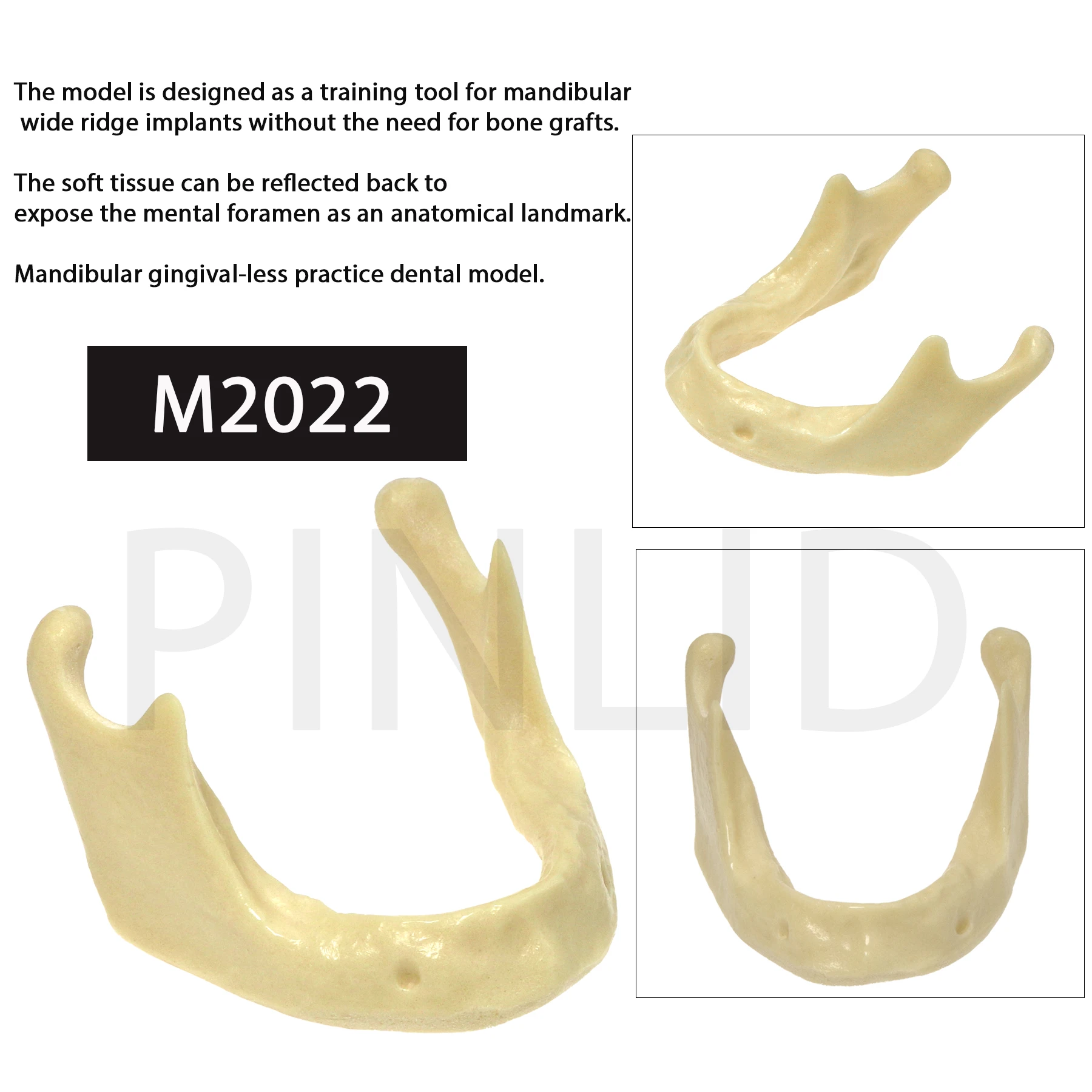 

Dental Mandibular Implant Model Simulation Bone for Drilling Practice M2022 Implant Model