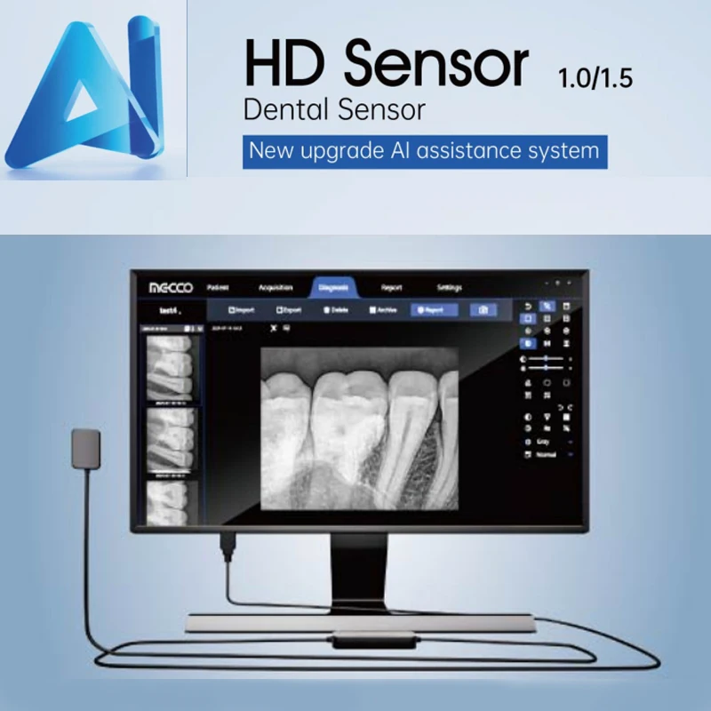 Sensore AI dentale Nuovo aggiornamento Sistema di assistenza Al Sensore HD, diagnosi intelligente, riconoscimento delle strutture, rilevamento delle carie