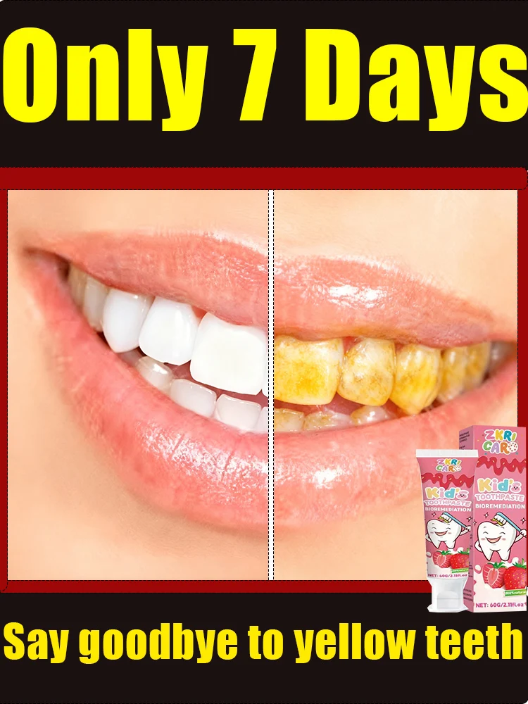 Nova atualização de 2a geração, removedor de tártaro dissolve tártaro e remove manchas