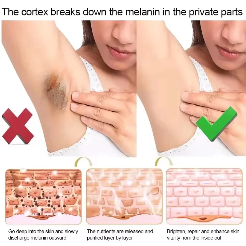كريم تفتيح الميلانين نيكوتيناميد للبشرة الداكنة، كريم تفتيح الفخذ الداخلي، كريم تفتيح الأجزاء الخاصة