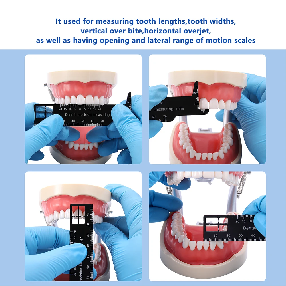 AZDENT Dental Präzisionsmesslineal Kieferorthopädische Zahnlücke Fotografie Medizinisches Werkzeug Aluminiumlegierung Zahnmedizin Messlehre – Detail 5
