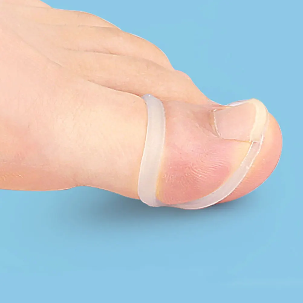 

10Pcs Elastic Toenail For Ingrown Toenail Correction, Soft Silicone Circles, Foot Care Tool, Toenail Stretching Devices