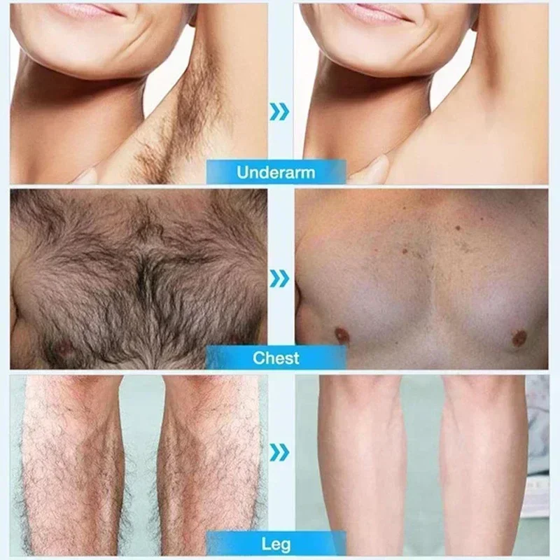 Hot sales Painless Hair Removal Cream Intimate Areas, Legs, Chest, Arms and Back Mild and Smooth Skin, Fast and Easy Hair Remova