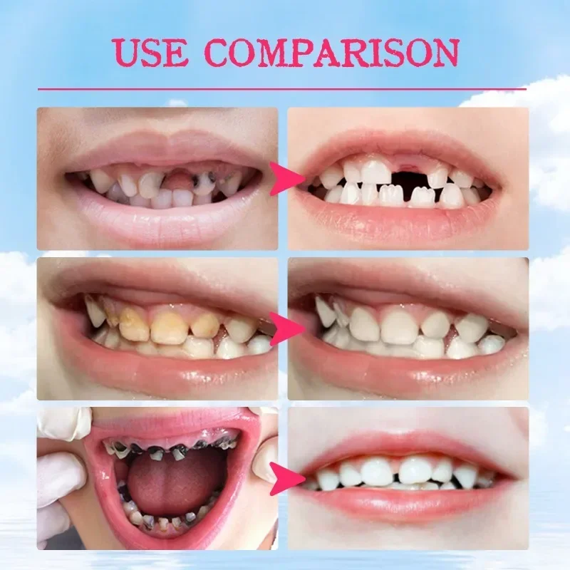 Sdatter Children's Foam Toothpaste Teeth Whitening Mousse Toothpaste Oral Cleaning Whitening Dental Care Fruit Flavor Kids Teeth