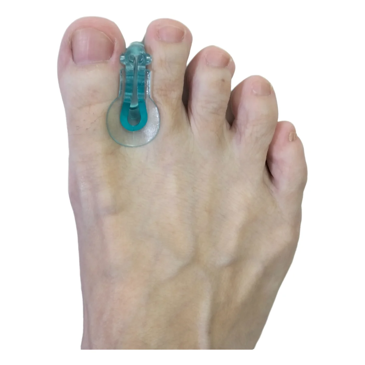 1/5/10Pairs Gel Toe Orthosis Clip Pads Big Splitter Thumb Hallux Valgus Bunion Corrector Overlap Separator Foot Care Pedicure