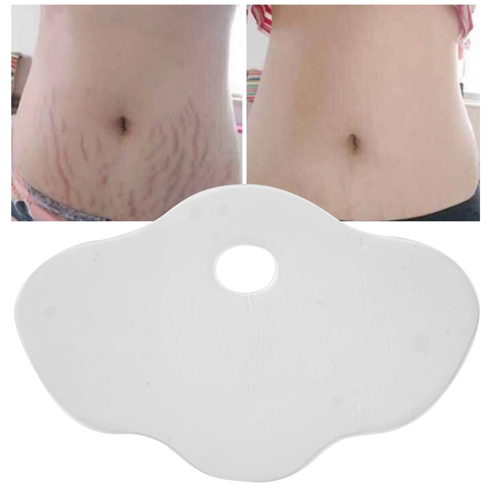 Reusable Silicone Belly Anti-Wrinkle Pads Abdomen Stomach Stickers Scar Stretch Marks Removal Sheets Reduce Wrinkles for Women