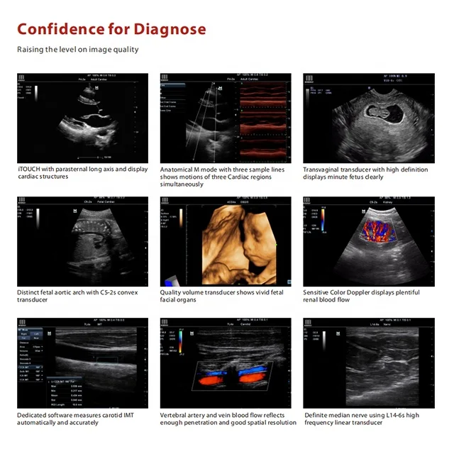 M7 Mindray Professional Portable 3D/4D Color Doppler Ultrasound Machine, ecografo mindray m5 m7 m9