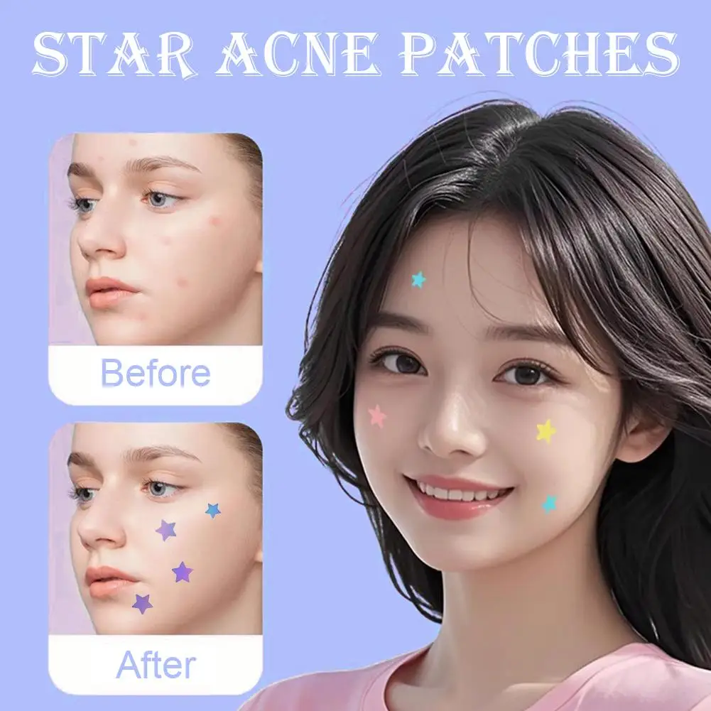 Multi-Color Star Acne Care Patch Concealer Patches Dissolve Blemishes While You Sleep Pimple Cover Sticker Skincare Beauty Tool view 4