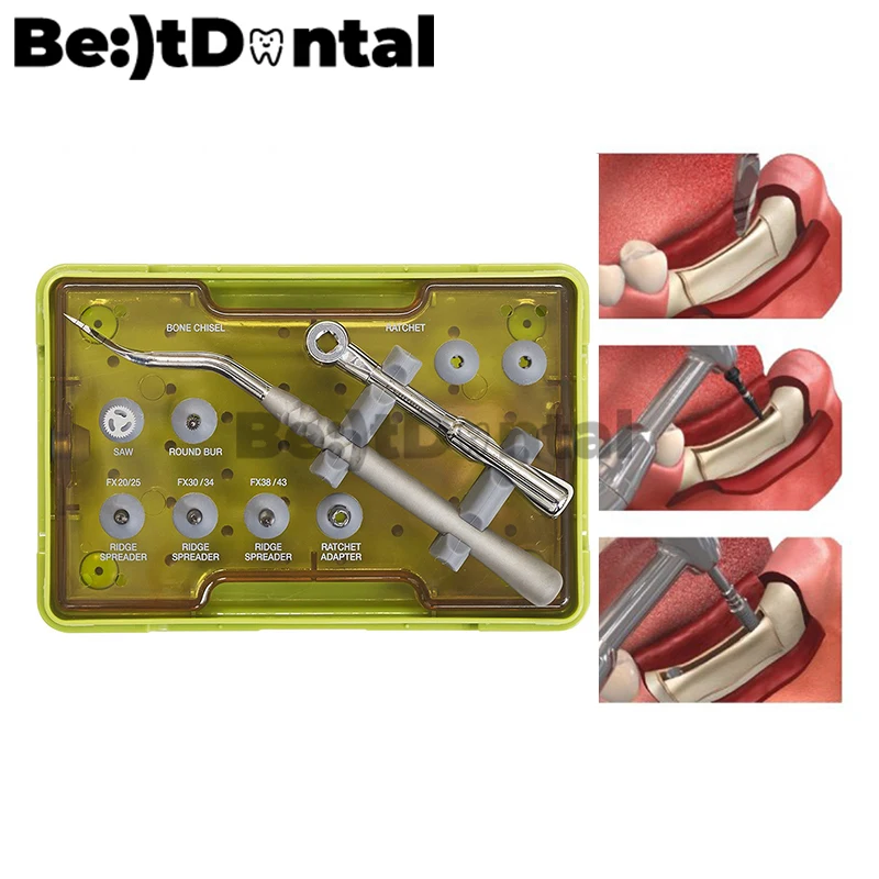 Drills RS Kit 100% Original Dentium XRSK Dental Implant Surgery Tools Dentium Ridge Spreader Drills RS Kit