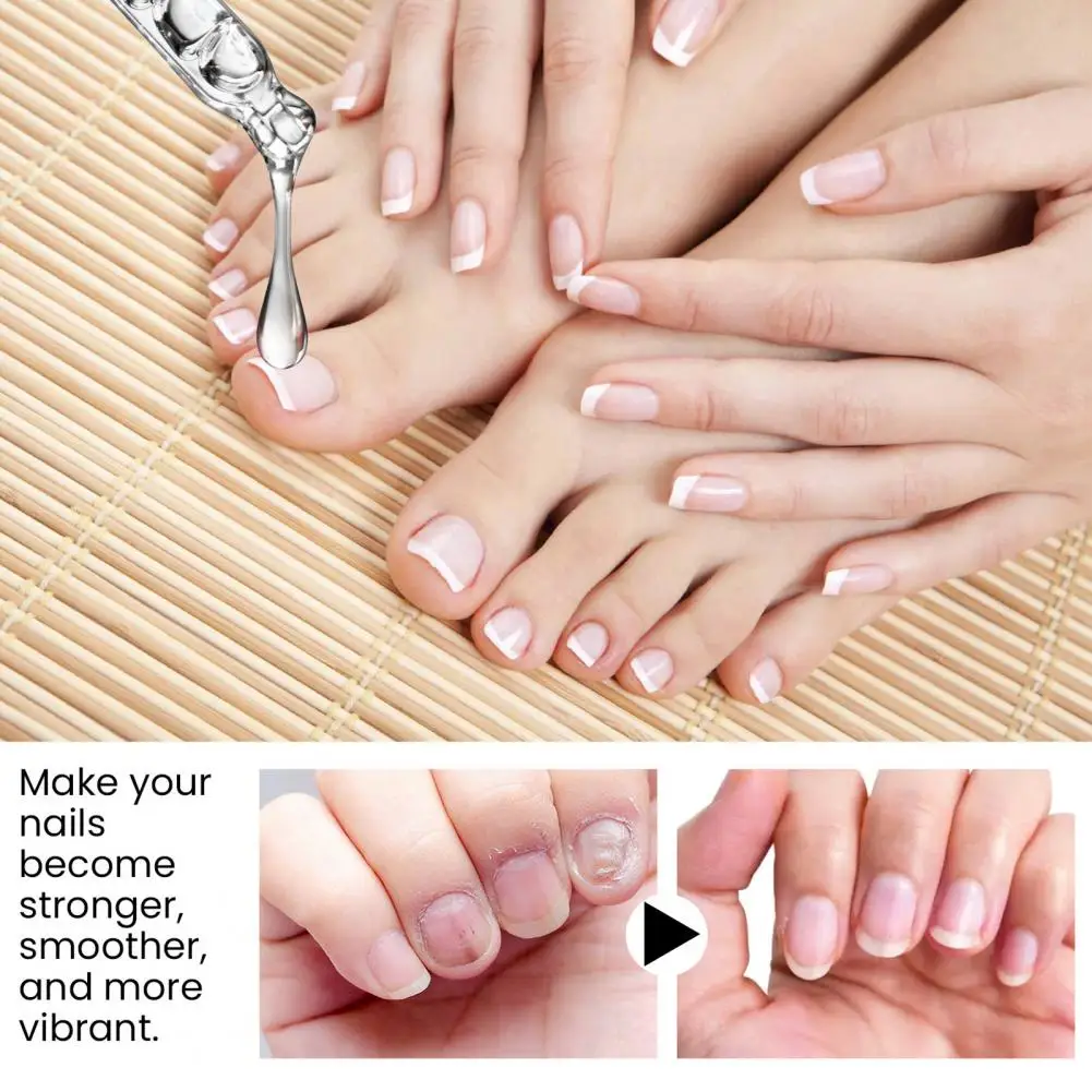 Óleo de fortalecimento de cutículas e unhas, Óleo hidratante para saúde, Ingredientes naturais, Cabelo rápido denso