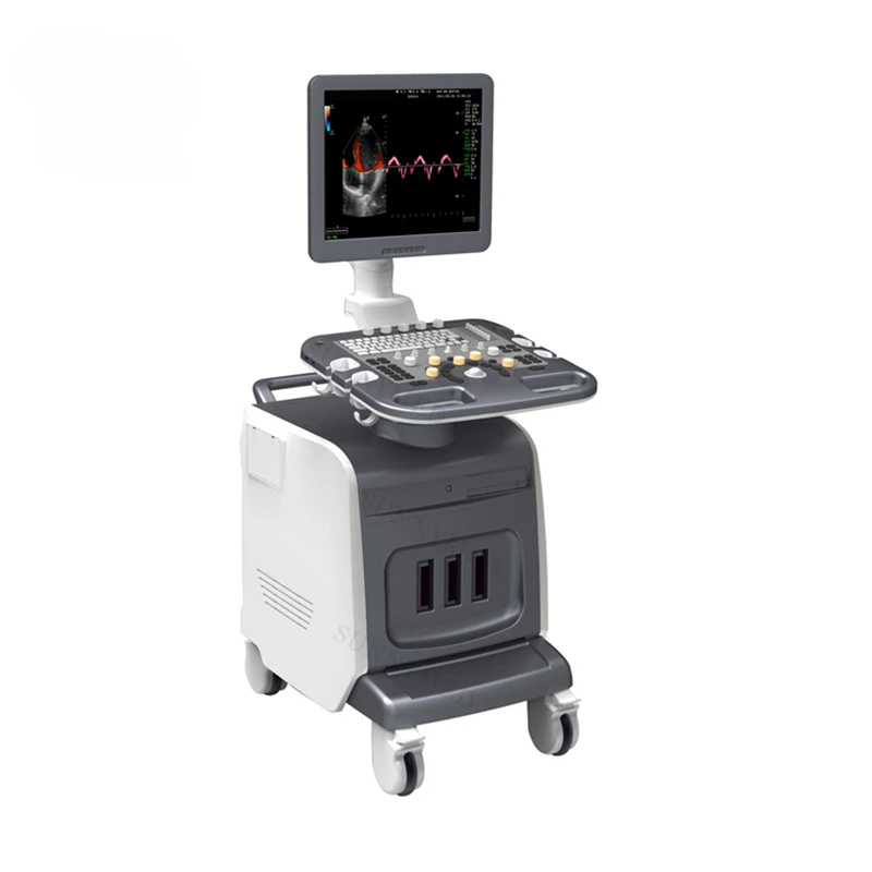 SY-A029 Color Doppler Ultrasound  Ultrasound Equipment China