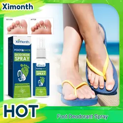 Foot Deodorant Spray Antibacterial Eliminate Bad Smell Anti Itching Infection Shoe Refreshing Perfume Foot Sweat Remover Liquid