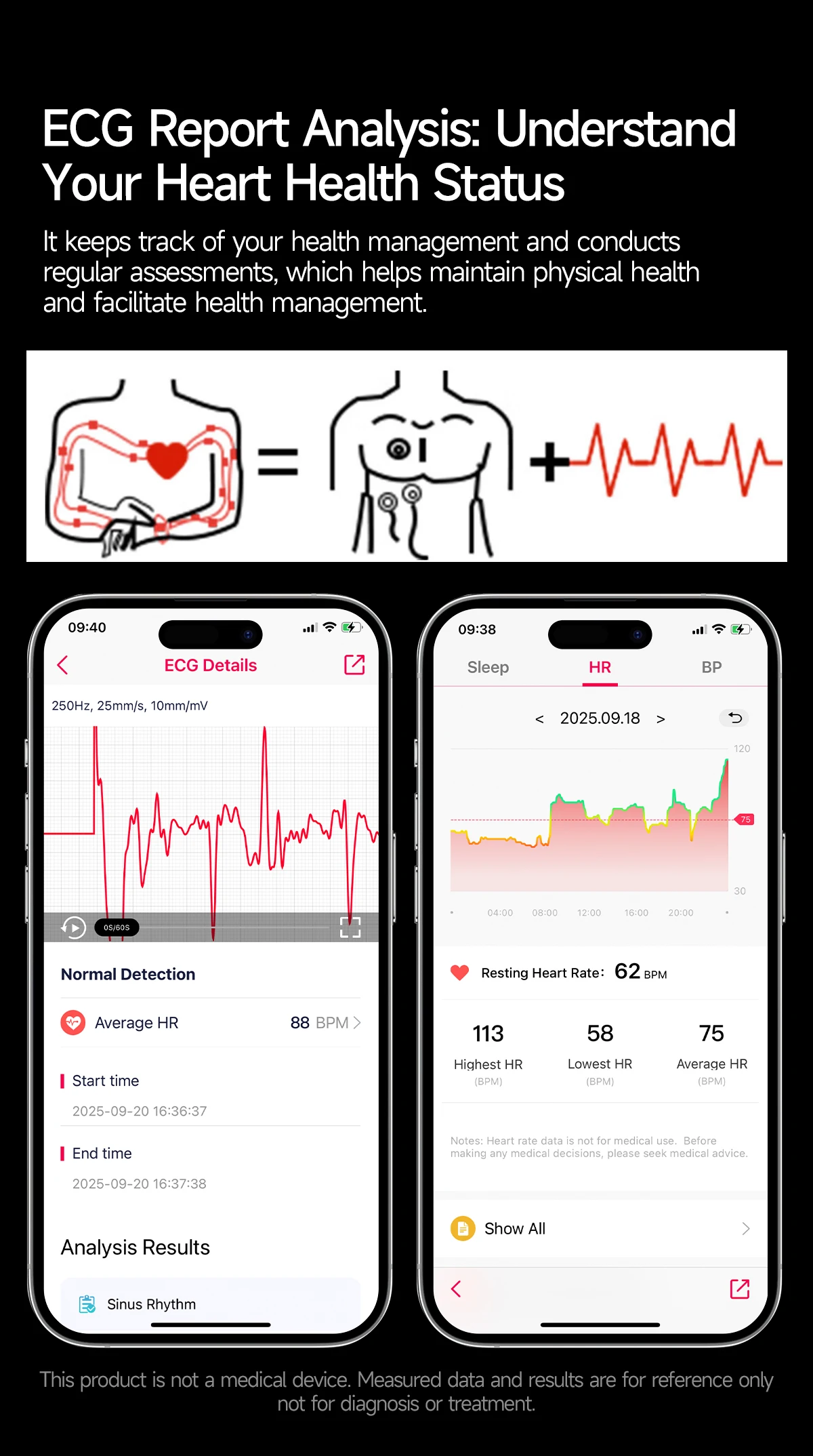2026 Neue KI-Gesundheitsdiagnose EKG Smartwatch für Männer und Frauen, Harnsäure, Lipide, Blutdruck, HD AMOLED-Bildschirm, Anruf-Sport-Smartwatch – Detail 8