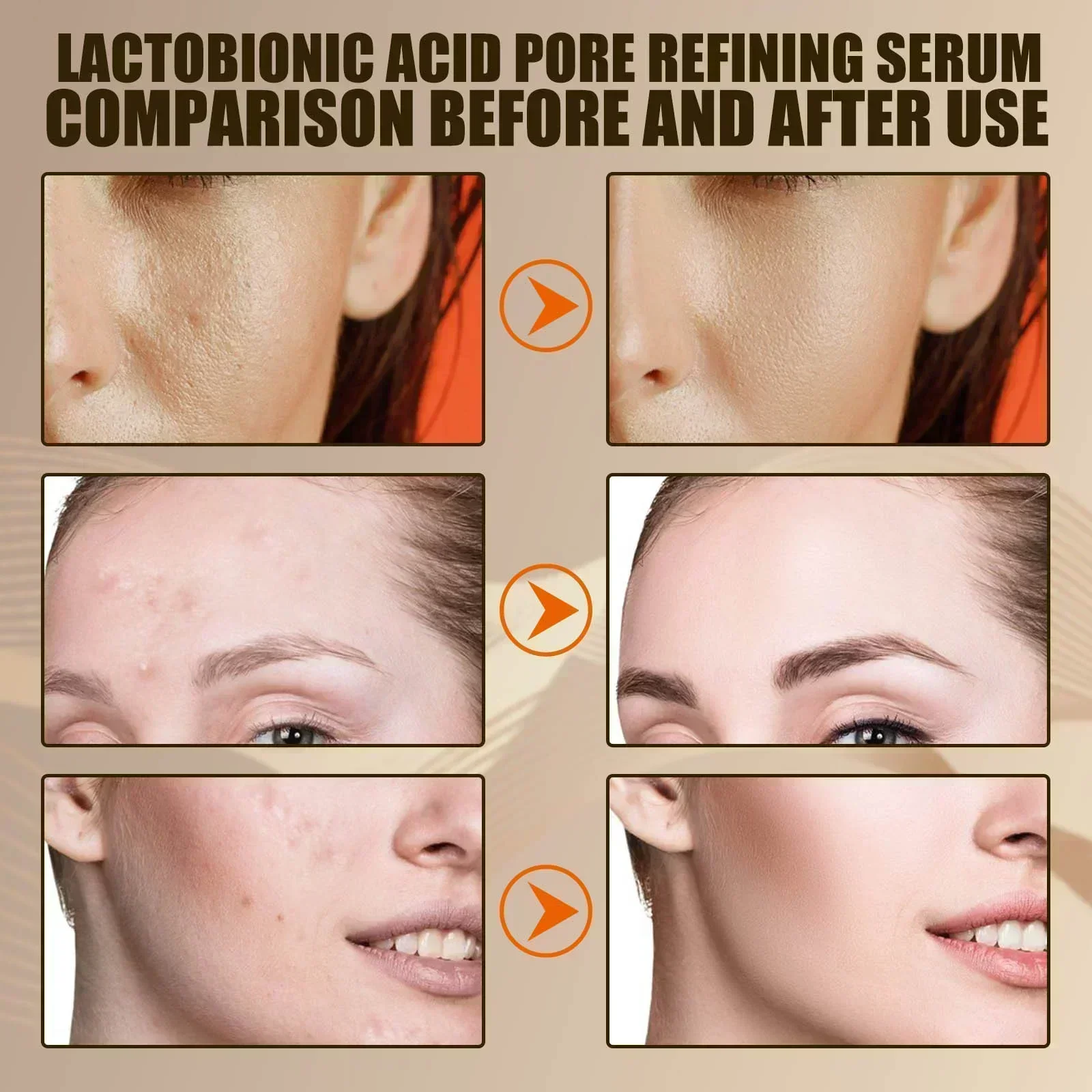 Pore Shrink Face Serum Remove Blackheads Acne Acidity Oil Control Repair Essence Moisturizing Nourish Pores Firming Facial Care