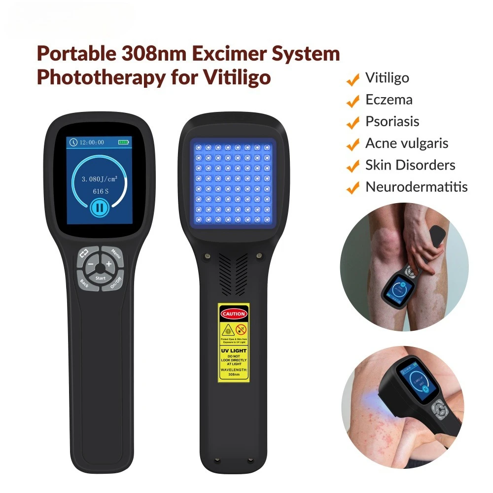 

Frovab 308nm UVB Targeted Treatment for Vitiligo Psoriasis Eczema Skin Disorder 64 Diodes High Efficiency Phototherapy Lamp