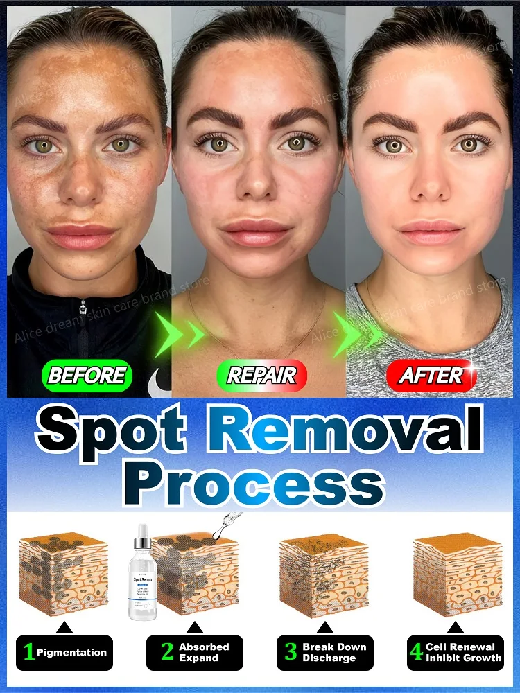 Effectively solves all pigmentation symptoms