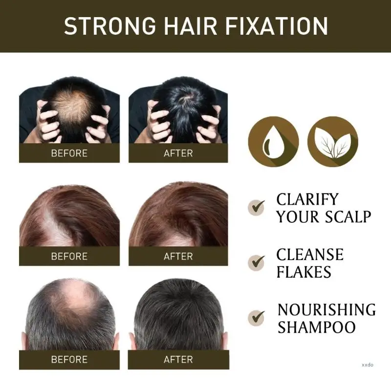 EELHOE-productos para el crecimiento del cabello para mujeres, esencia de romero, aceite esencial de rebrote rápido, hidratante multiefecto, cuidado del cabello grueso