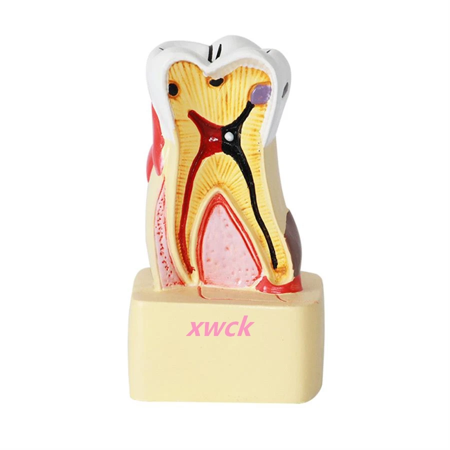 1 PCS Human Dental Models Oral Care Healthcare Models