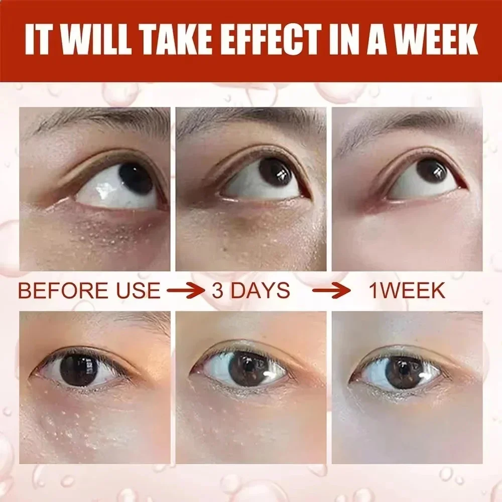 ไขมันเม็ดRemoverครีมบํารุงรอบดวงตาปรับปรุงEye Bag Fade Fine Lines Dark Circle Moisturizing Anti-Puffiness Lifting Firming Eye Care