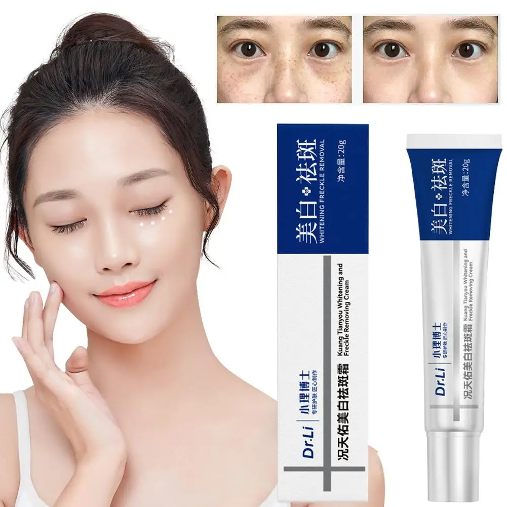 

20g Whitening Freckles Cream Remove Melasma Dark Spot Marks Care Brightens Skin Tone Skin Lightening Face Acne V8N5