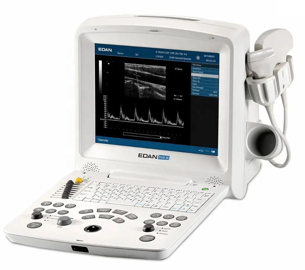 Advanced Edan DUS 60 VET Digital Ultrasound Machine for Vet Portable