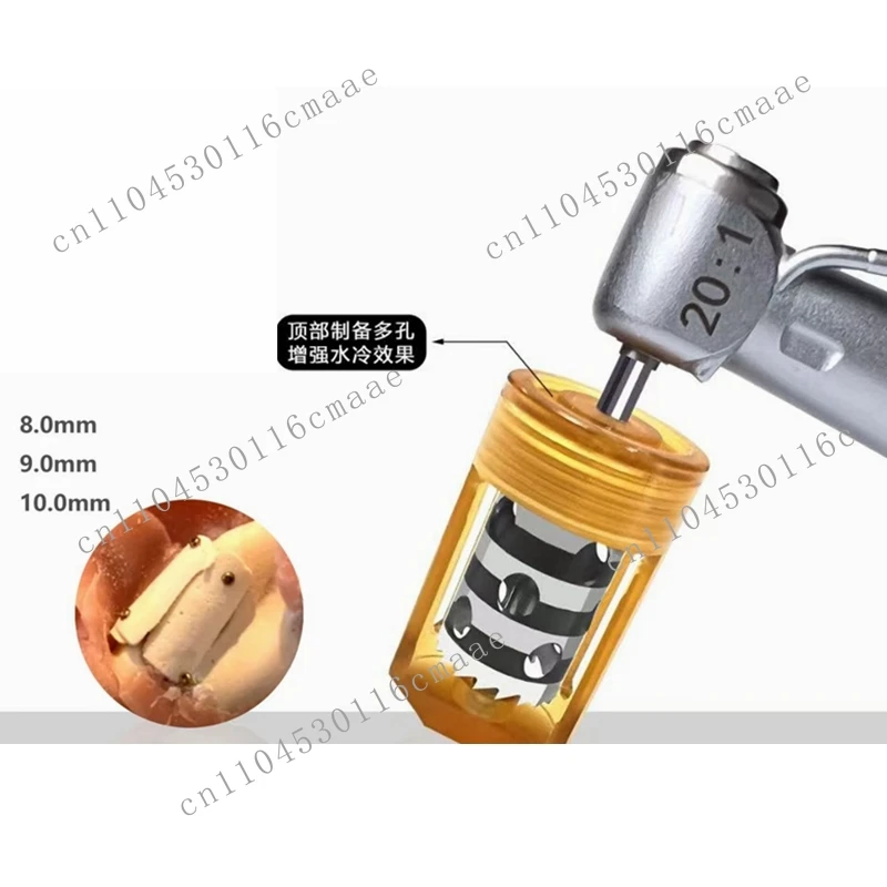 신제품 기타 장비 외과 기구 이지 세미루나 뼈 쉘 콜렉터 8.0mm 9.0mm 10.0mm 정형외과 드릴