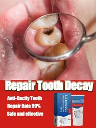 Cavities and protect teeth Tooth decay repair Repair all tooth decay, Remove plaque Toothache relives periodontitis