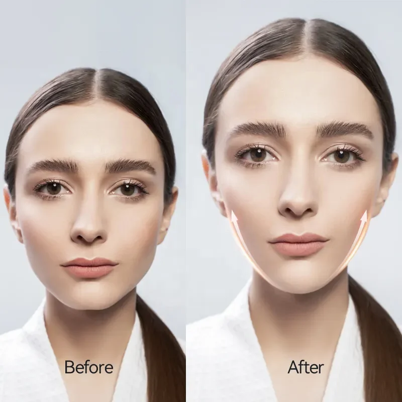 المكتبة الذكية جهاز شد الوجه مزيل الذقن المزدوج V-face الذقن رفع مدلك الوجه شد الوجه USB قابلة للشحن ABS والبقع #6