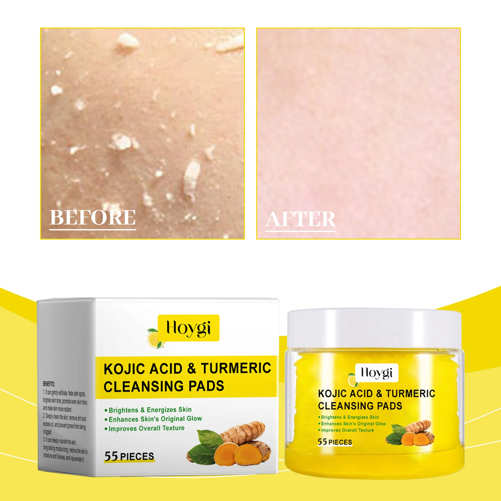 4 Stück Kurkuma-Reinigungs-Peeling-Pads für die Hautpflege, sanfte Formel, geeignet für alle Hauttypen [55 Stück/Flasche]