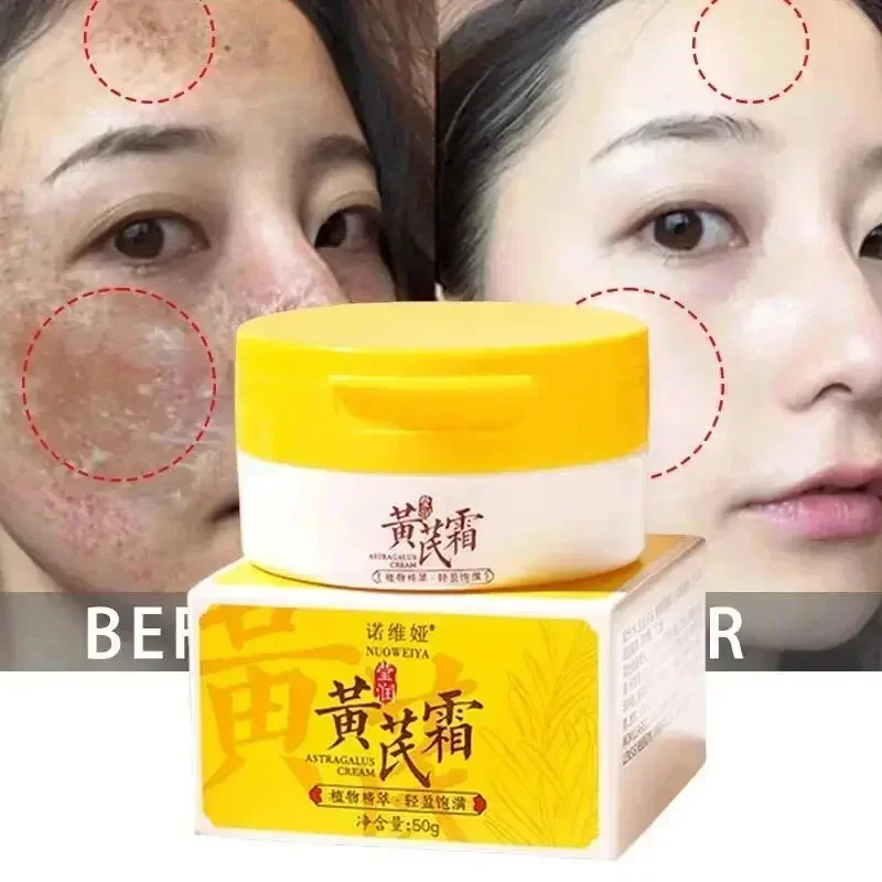 

Astragalus Whitening Freckle Cream Face Remove Dark Spots Melasma Lighten Melanin Acne Scars Anti-aging Brighten Black Skin Care