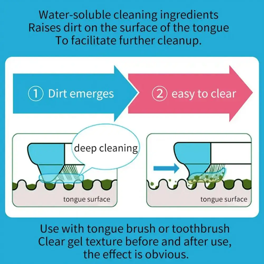 Gel nettoyeur de langue et grattoir à langue, ensemble pour remodeler les odeurs de la bouche et éliminer la mauvaise haleine