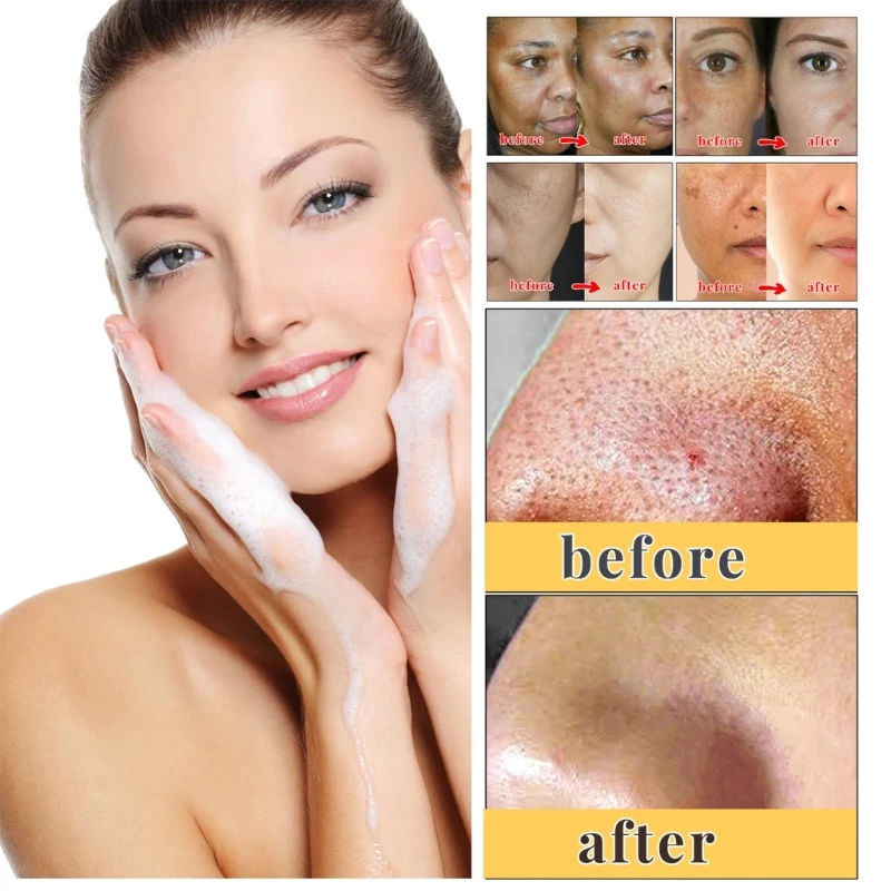 мыло с койевой кислотой и витамином С, гиалуроновая кислота, кокосовое масло, глубокое очищение, мягкое мыло для лица, масло для