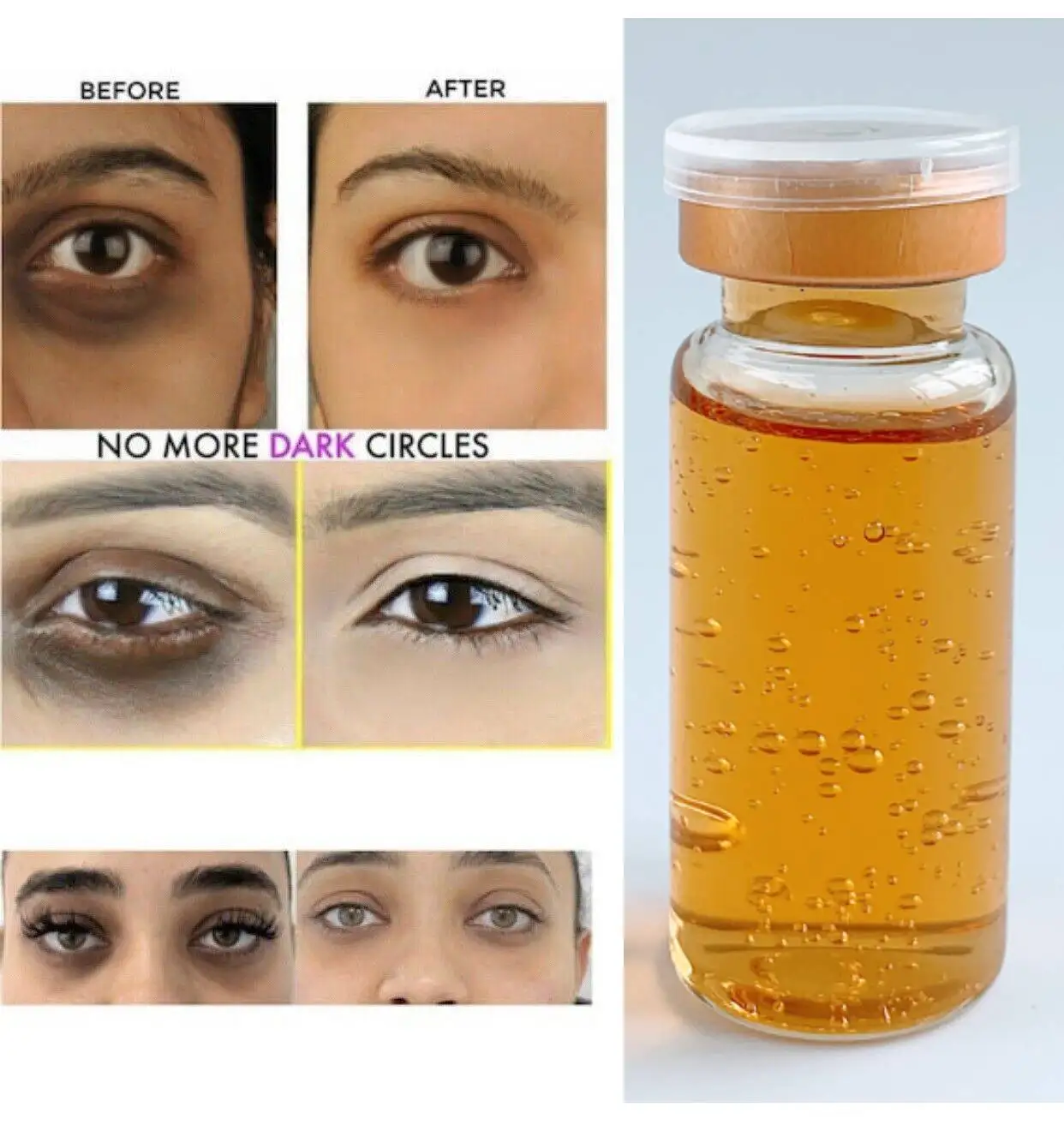 Dark Circles Remover REDUCE EYE BAGS & WRINKLES Undereye Lightening Serum 7 Days Action