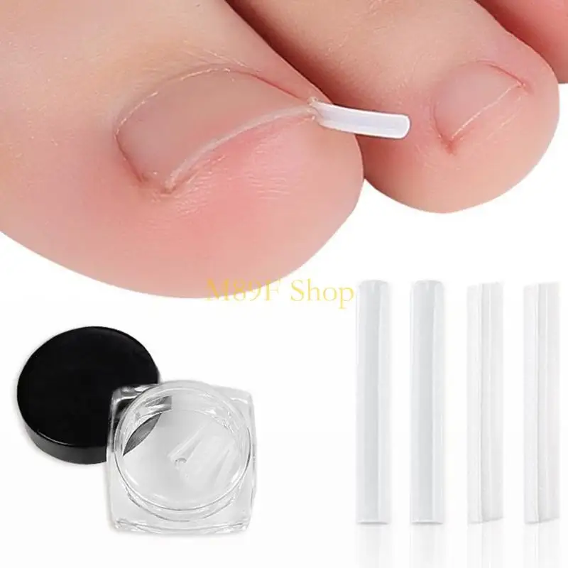 M89f Ingne piede unghia sede strumento pedicure strumento pedicure strumento piede in unghie dei piedi.