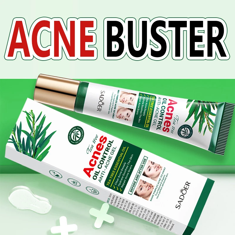 Acne cream, acne mark repair, acne mark fading, genuine acne cream, closed comedones, specially for male and female students