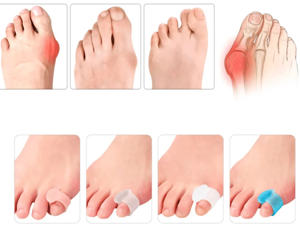 

1/3/6Pairs Separator Finger Feet Care Protector Silicone Toe Orthopedic Bunion Corrector Hallux Valgus for Pedicure