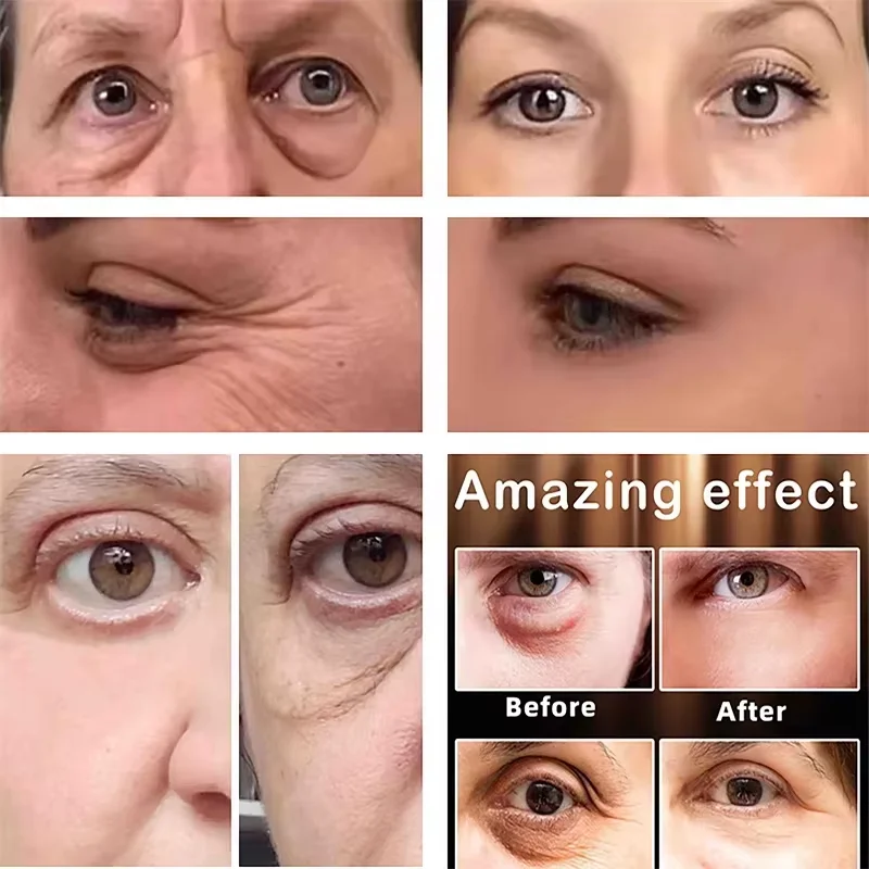 Fast Instant Eye Bag Removal Cream Collagen Removal Wrinkles Firming Skin Fade Fine Lines Brighten Dark Circle Remove Eye Care