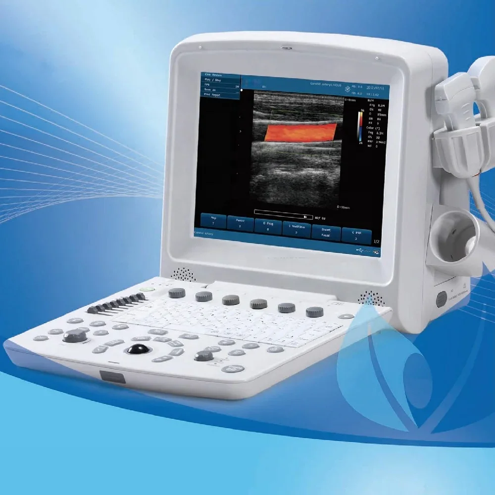 EDAN U50 Scanner Machine ecografo ultrasonido Laptop Color Doppler portable ultrasound price