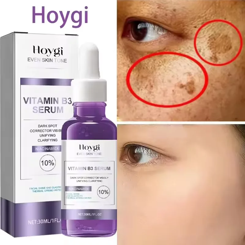 

Powerful Dark Spots Remover Face Whitening Serum Freckle Melanin Correcting Anti Pigmentation Brighten Skin Beauty Care Products