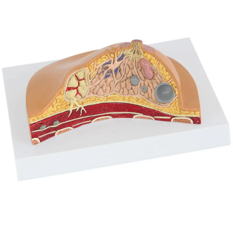 여성 의료 병리 질병 암 유방 해부학 모델, 인체 해부학