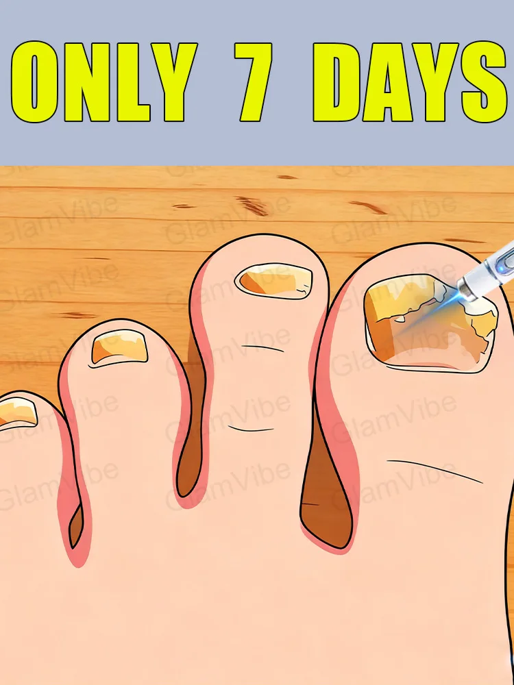 

Blue light nail fungus removal, discounted sets