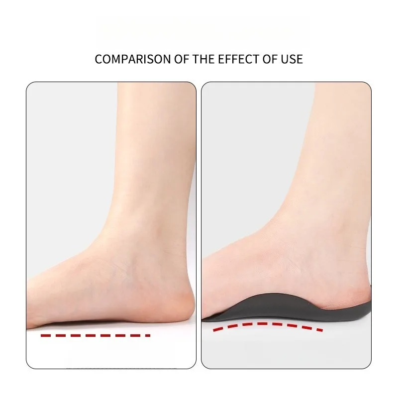 1Pair Orthotics Insert  Arch Support Pad Orthopedic Insoles Flat Foot Sole Pad for Unisex S/L(skin Color)