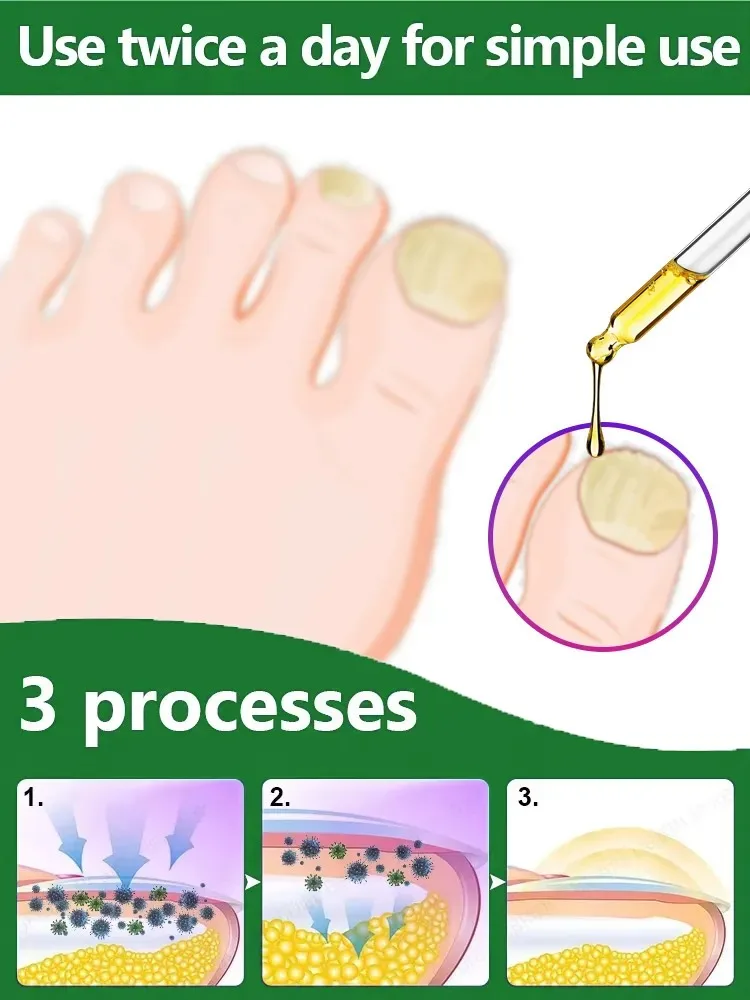 2025 Nieuwe nagelversterkingsmachine met 3 modi - Reparatie gebarsten en peelende nagels in 2 weken 10