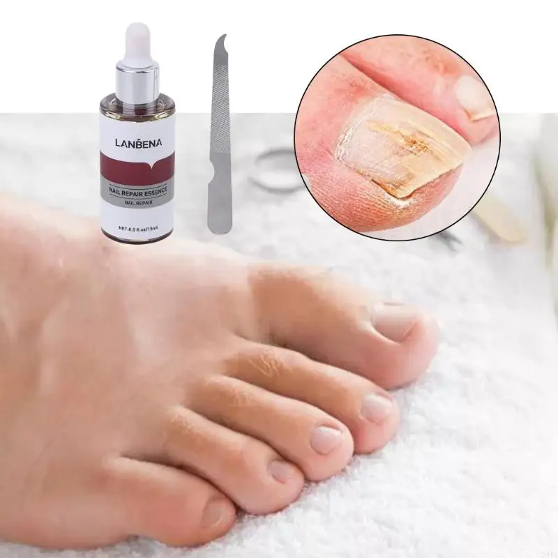 28TA 12ml Herbal Extract Repair Essence with File Removal Serum Nourish Brighten Hand Foot Anti