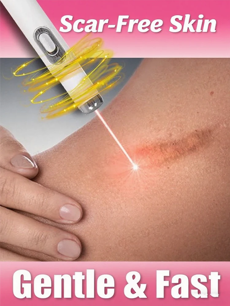 

Blue light pen for scar treatment, free shipping, scar management tool, painless, free shipping