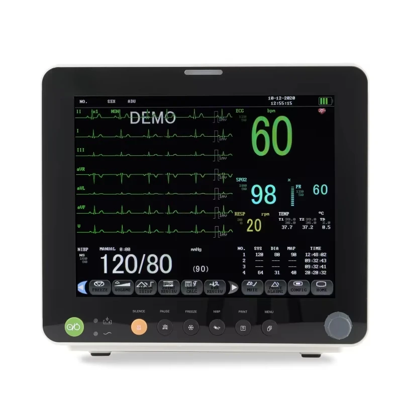 12 Inch Patient Monitor with Etco2 Multi-parameter Veterinary Vital Signs Monitor Pet Monitor