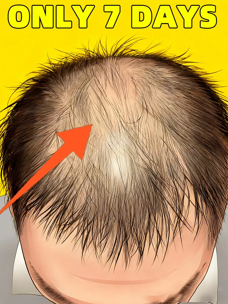 

Массажер против выпадения волос, инструмент для ухода за кожей головы, поколение-2, аппликатор для головы, жидкая расческа, портативная мини-массажная расческа, направляющая жидкость